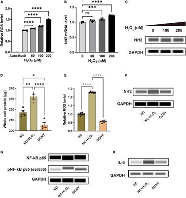 Chinese herbal formula (GCNY)-medicated serum alleviates peroxidation induced by H2O2 in human microglial cells